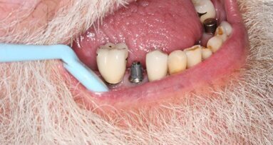 士卓曼购得美RODO Medical公司12%的股份