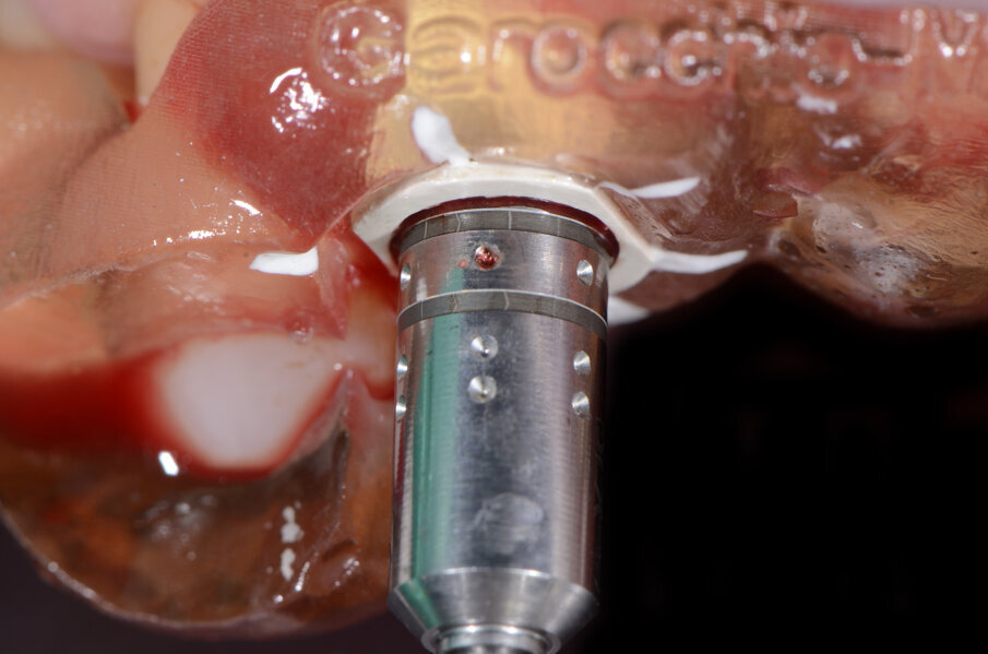 Fig. 30 - Alloggiamento finale.