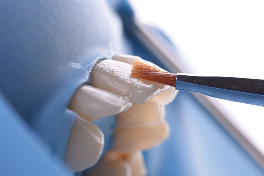 Sl. 12: Modelovanje finalne gleđne mase  kompozita četkicom 