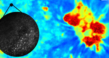 Pesquisadores rumo ao avanço no diagnóstico do câncer bucal