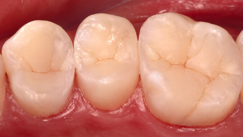 Résultats du Concours international de cas cliniques 2020/2021 de Dentsply Sirona