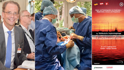 Implantologie in Konstanz: Jetzt anmelden! Implantologie in Konstanz: Jetzt anmelden!