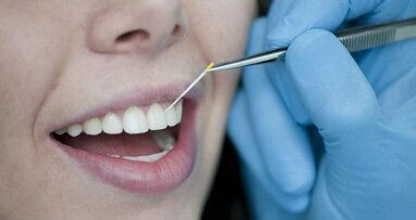 Parodontitis-Erreger schneller erkennen mit neuem Chip-Modul