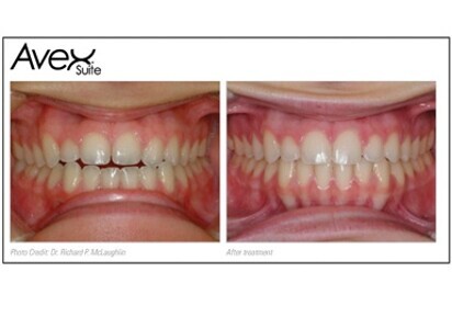 Board standard results through Avex Suite