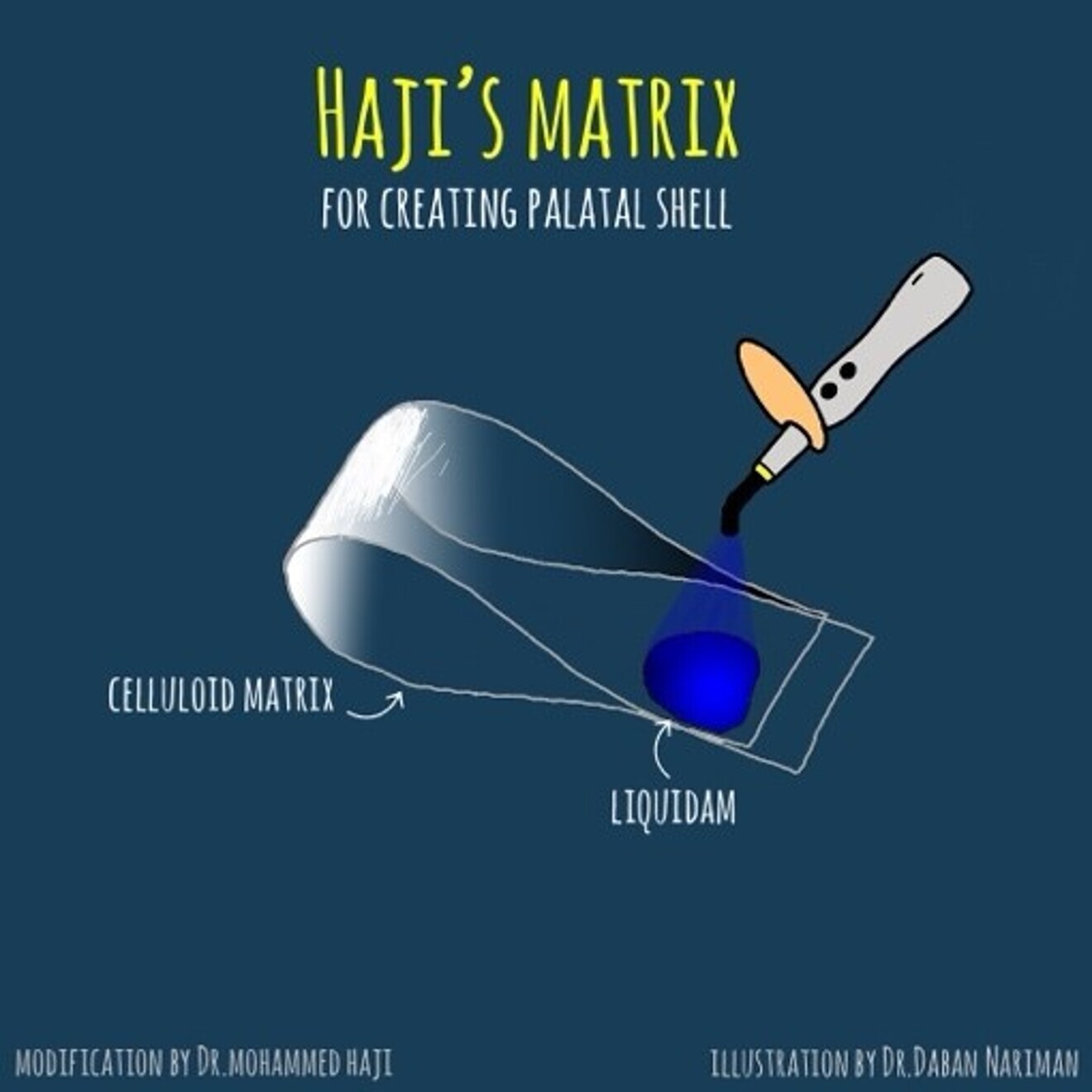 Fig. 1a: Celluloid Matrix stabilized with a liquid dam using Injectable composite.