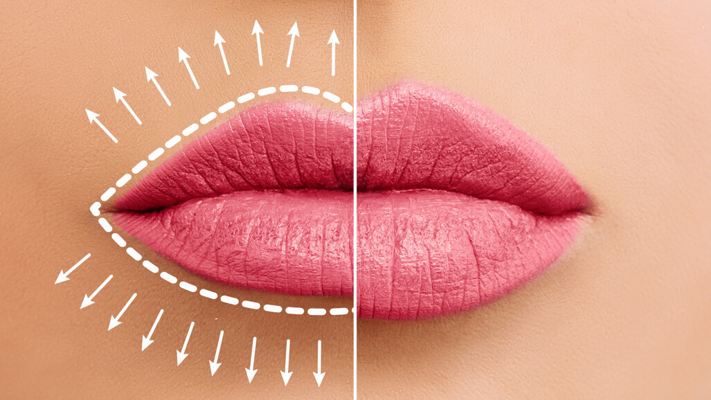 Une nouvelle étude examine l’impact de la taille des lèvres sur l’attractivité faciale