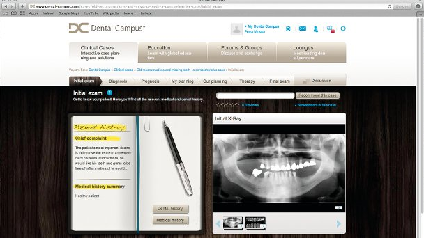 Днес на dtstudyclub.com: Експерт демонстрира лечебно планиране с помощта на модерни дигитални технологии