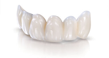 Rethinking provisionals: The many advantages of premade custom temporaries