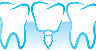 International Society of Metal-Free Implantology gegründet