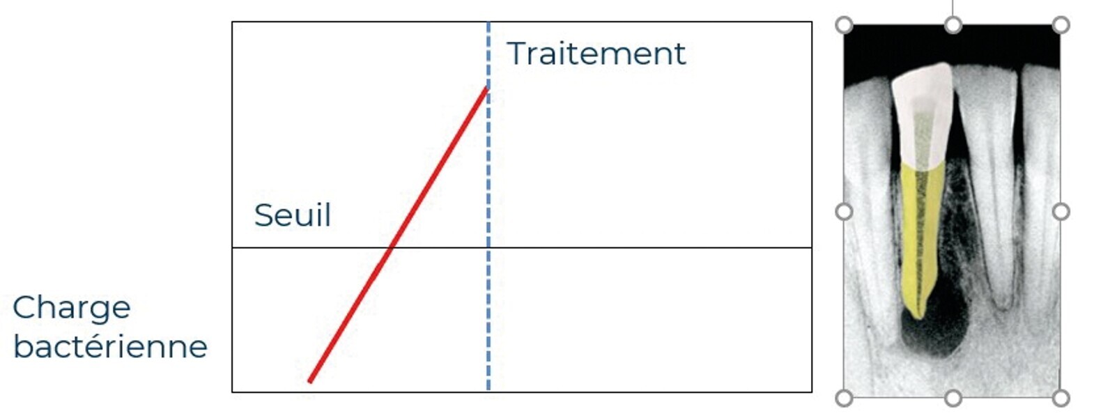 Fig. 3 : Illustration de l’apparition d’une lésion lorsque la charge bactérienne dépasse le seuil.