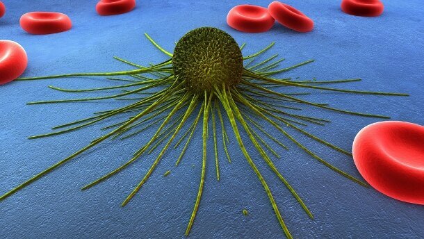 Une protéine serait capable d’empêcher l’apparition des métastases
