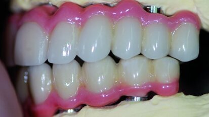 La réalité modifiée en prothèse conjointe