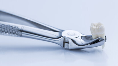 Scientists link childhood trauma to tooth loss later in life Scientists link childhood trauma to tooth loss later in life