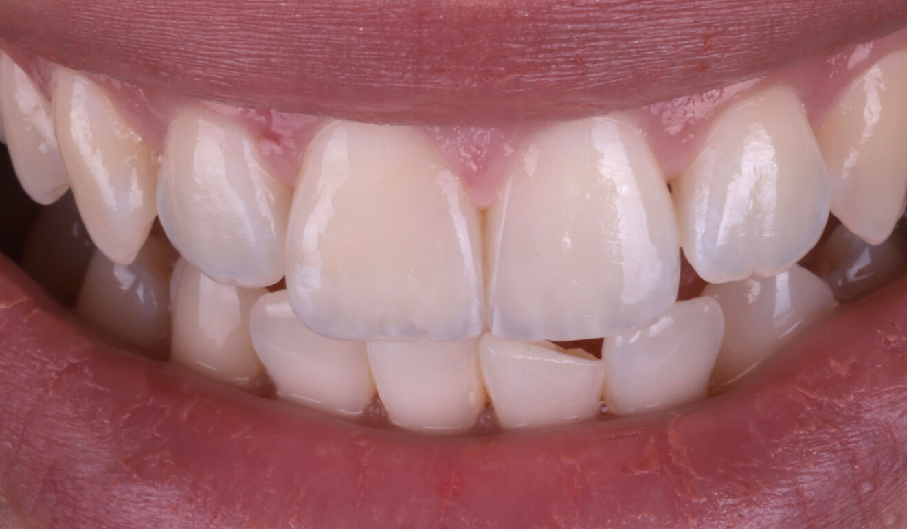 Fig. 21: Patient’s smile.