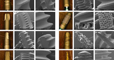 Una nueva forma de diseñar implantes dentales