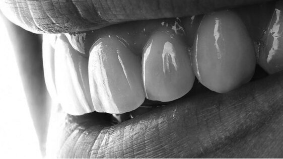 Jeden materiál na mnoho způsobů: Na vzdělávací akci ve Vídni řešili tři týmy jeden klinický případ