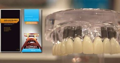 Implantologie für Experten und Einsteiger im Ruhrgebiet