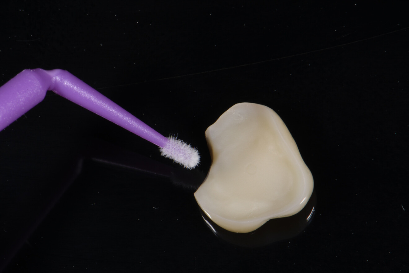 Fig. 25: Priming of the restoration with CLEARFIL CERAMIC PRIMER PLUS.