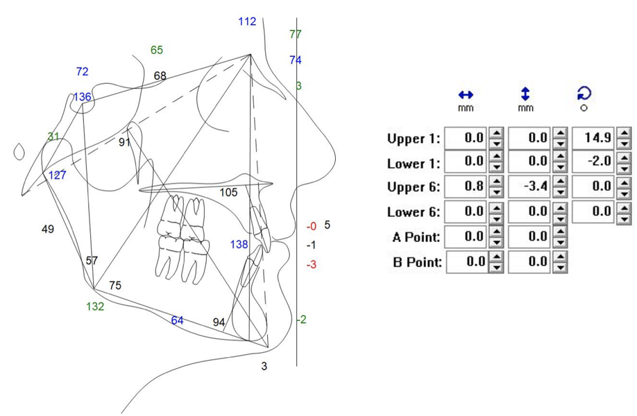 Fig. 44: Visual treatment objective.