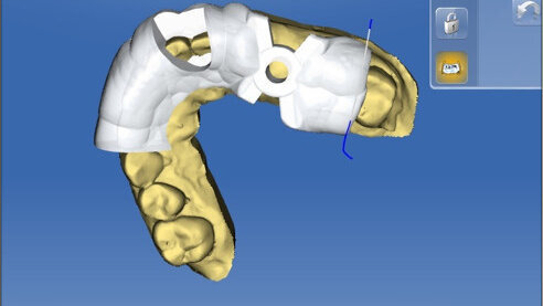 À l’aube de l’intelligence artificielle, comment tirer profit de la technologie pour garder la main sur nos traitements