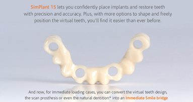 SimPlant® 15 – Maggiore predicibilità della procedura chirurgica e della ricostruzione protesica