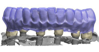 Il parere dell’Odontotecnico sui flussi di lavoro nei laboratori