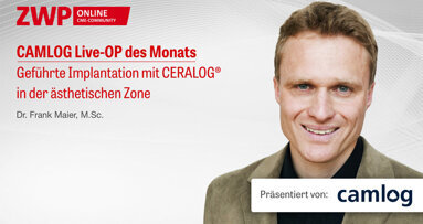1 CME-Punkt: CAMLOG Live-OP mit Dr. Maier im Archiv