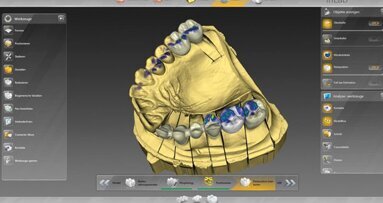 Sirona – Il software inLab, completamente rivisitato, offre una libertà straordinaria