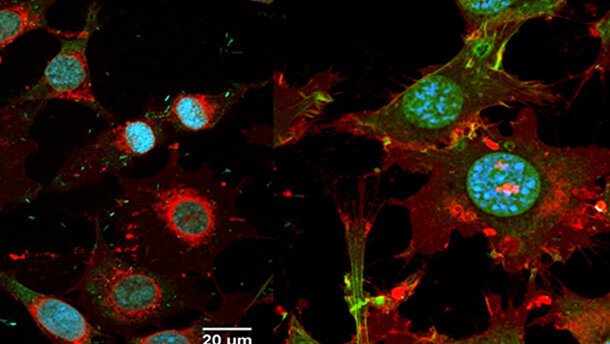 Internationales Forscherteam entwickelt keimreduzierende Implantate