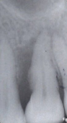 Fig. 2b - Situazione rx a tempo 0.