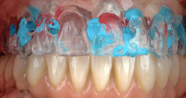 Approccio digitale multidisciplinare per un caso clinico complesso