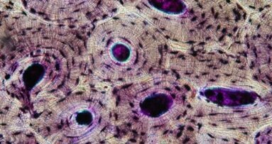 Unikatowy projekt hodowli komórek ludzkich kości