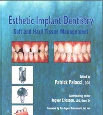 Esthetic Implant Dentistry: Soft and Hard Tissue Management