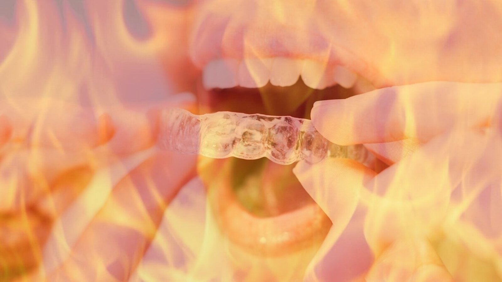 ¡Cuidado con los tratamientos dentales que se publicitan en redes!