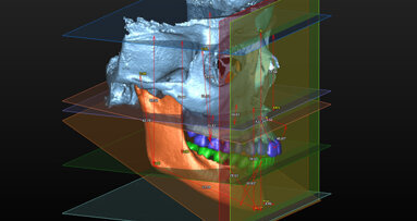 Comunicazione ortodontica per immagini del terzo millennio: dal 2D al 3D