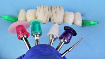 The MiCD approach to patient-centric smile enhancements