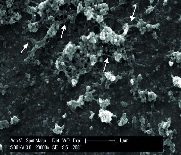 Fig. 10 b : Micrographies sous un grossissement de 20 000 fois montrant la présence de la pellicule sur les échantillons de titane (a) et d’email (c) servant de contrôle par rapport au titane rince avec HAP II (b) et a l’email rince avec HAP III (d). Deux heures après l’exposition buccale ont ces solutions, les images prises sous plus fort grossissement permettent d’observer les structures de connexion entre la solution de HAP II et la surface en titane (b) et entre la solution de HAP III et la surface de l’email (d). Les HAP sont en contact direct avec des structures globulaires de la pellicule exogène acquise. Les flèches indiquent les ponts 
