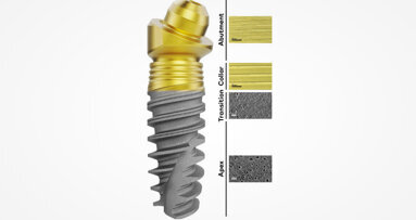 Nobel Biocare launches Xeal and TiUltra surfaces in US