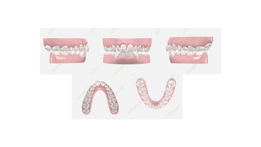 Figg. 16-20_Set-up digitale risultato previsto.