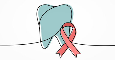 HAART treatment for HIV/Aids patients plays key role in their oral health