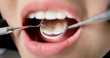 Wetenschappers ontwikkelen nieuw restauratiemateriaal