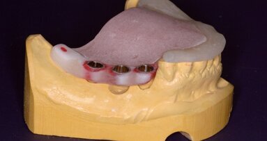 Image guided surgery