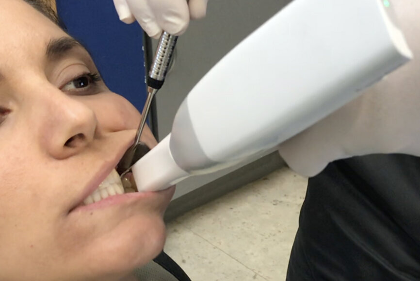 Fig. 20b: Digital recording of intercuspation.