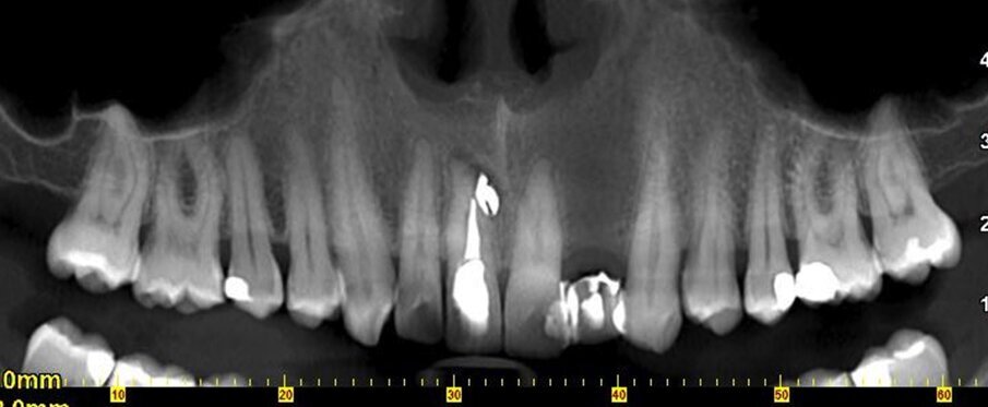 Situazione maggio 2016.