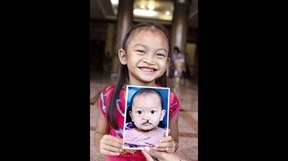 MiSmile founder shares the central role philanthropy plays in the business