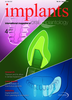 implants international No. 4, 2017 implants international No. 4, 2017
