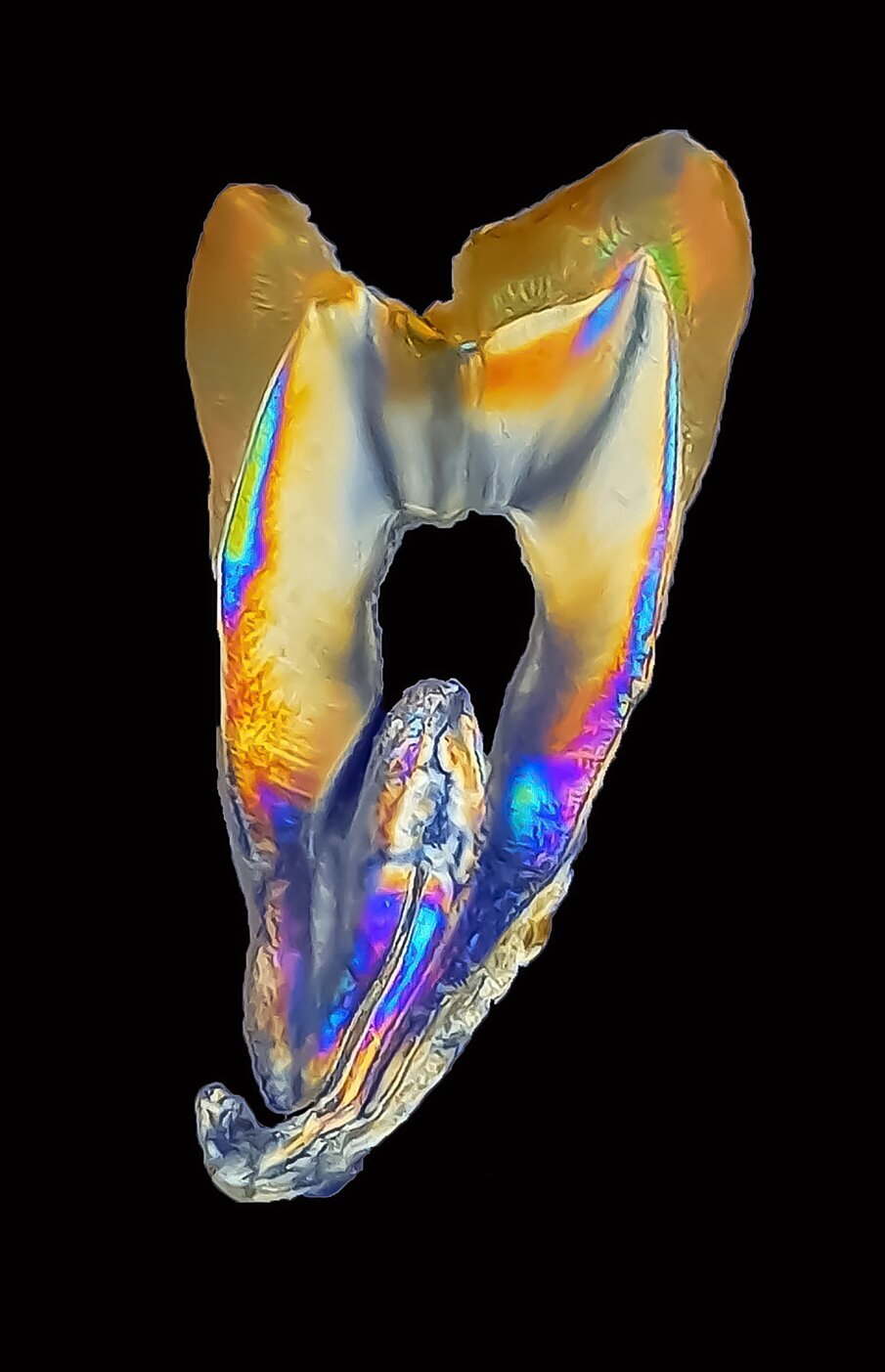Tooth structure