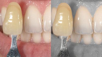 La cámara más sofisticada y fácil de usar