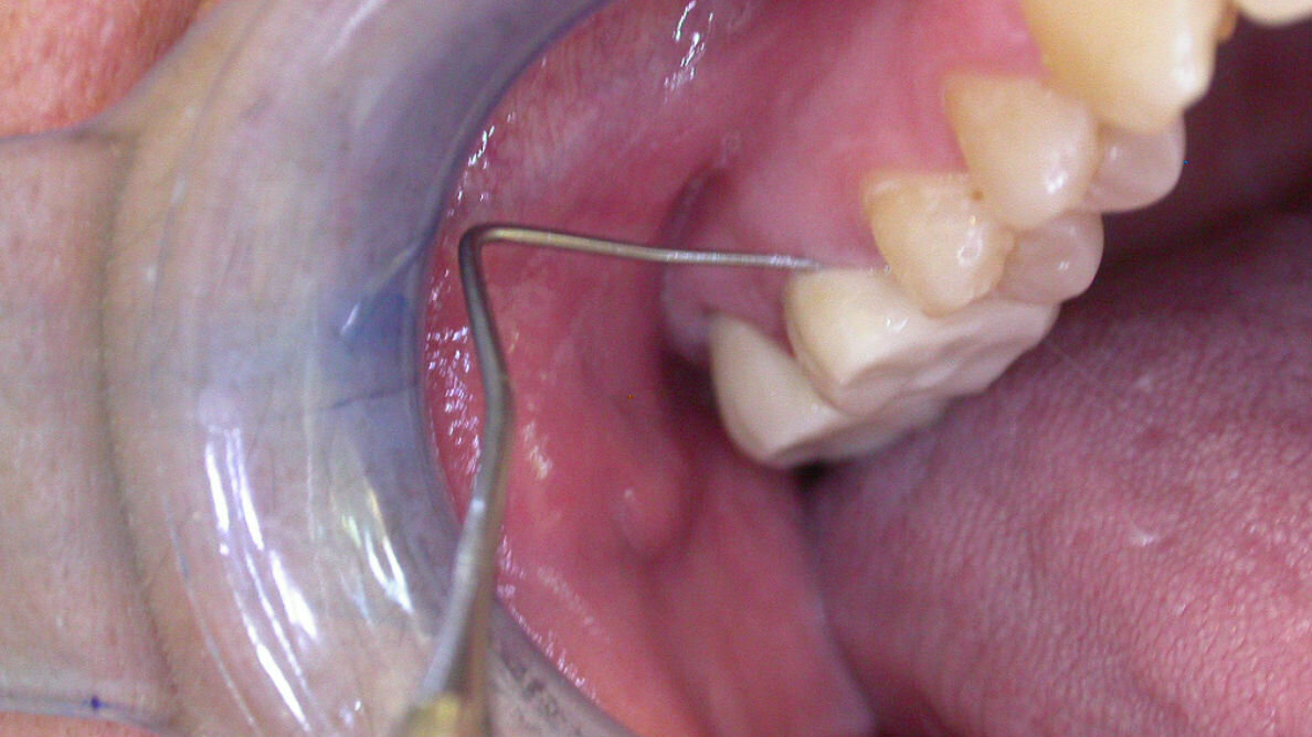 Negare l’evidenza, non aiuta a nascondere gli errori, favorisce solo il contenzioso