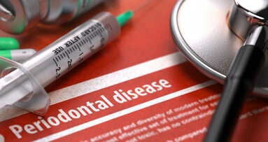 Correlazione tra aterosclerosi coronarica e disturbi parodontali